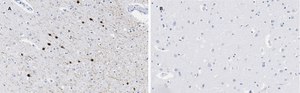 Anti-Calretinin Antibody, clone 3K22, ZooMAb® Rabbit Monoclonal recombinant, expressed in HEK 293 cells