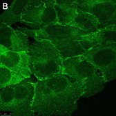 Anti-PARD-3 Antibody, clone 1N18 ZooMAb® Rabbit Monoclonal recombinant, expressed in HEK 293 cells