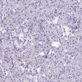 Anti-DBN1 antibody produced in rabbit Prestige Antibodies® Powered by Atlas Antibodies, affinity isolated antibody, buffered aqueous glycerol solution