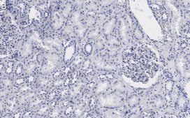 Anti-53BP1 Antibody, clone 1H16 ZooMAb® Rabbit Monoclonal recombinant, expressed in HEK 293 cells