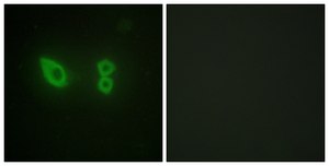 Anti-Actinin α antibody produced in rabbit affinity isolated antibody