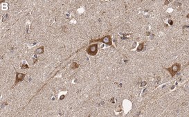 Anti-EphA2 Antibody, clone 2C3 ZooMAb® Rabbit Monoclonal recombinant, expressed in HEK 293 cells