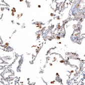 Anti-CTSB antibody produced in rabbit Prestige Antibodies® Powered by Atlas Antibodies, affinity isolated antibody, buffered aqueous glycerol solution