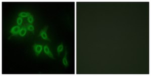 Anti-Collagen V α2 antibody produced in rabbit affinity isolated antibody