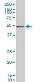 Monoclonal Anti-ALDH2 antibody produced in mouse clone 1E5, purified immunoglobulin, buffered aqueous solution