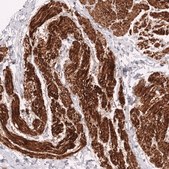 Monoclonal Anti-Myh11 Antibody Produced In Mouse Prestige Antibodies® Powered by Atlas Antibodies, clone CL14619, affinity isolated antibody, buffered aqueous glycerol solution