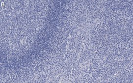 Anti-Cytokeratin 5/6 Antibody, clone D5/16 B4 ZooMAb® Mouse Monoclonal recombinant, expressed in HEK 293 cells