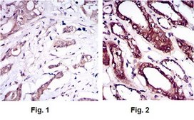 Anti-BMPR-1A, clone 4B7B2 Antibody ascites fluid, clone 4B7B2, from mouse