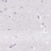 Anti-PRL antibody produced in rabbit Prestige Antibodies® Powered by Atlas Antibodies, affinity isolated antibody
