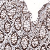 Monoclonal Anti-ARID1A antibody produced in mouse Prestige Antibodies® Powered by Atlas Antibodies, clone CL3595, purified immunoglobulin, buffered aqueous glycerol solution