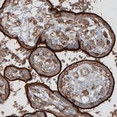 Monoclonal Anti-EZR antibody produced in mouse Prestige Antibodies® Powered by Atlas Antibodies, clone CL2375, purified immunoglobulin, buffered aqueous glycerol solution