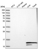 Anti-HBA1 antibody produced in rabbit Prestige Antibodies® Powered by Atlas Antibodies, affinity isolated antibody, buffered aqueous glycerol solution