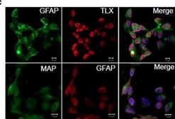 Anti-MAP2 (2a+2b) antibody, Mouse monoclonal ~2 mg/mL, clone AP-20, purified from hybridoma cell culture