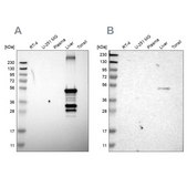 Anti-CYP2C8 antibody produced in rabbit Prestige Antibodies® Powered by Atlas Antibodies, affinity isolated antibody, buffered aqueous glycerol solution
