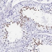 Anti-HDGFL1 antibody produced in rabbit Prestige Antibodies® Powered by Atlas Antibodies, affinity isolated antibody, buffered aqueous glycerol solution
