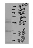 Anti-CETP antibody produced in rabbit affinity isolated antibody