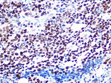 Anti-KAT1/HAT1 antibody produced in rabbit
