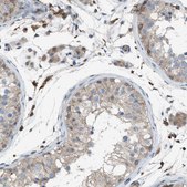 Anti-DYRK1A antibody produced in rabbit Prestige Antibodies® Powered by Atlas Antibodies, affinity isolated antibody, buffered aqueous glycerol solution
