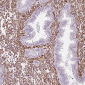 Anti-FKBP10 antibody produced in rabbit Prestige Antibodies® Powered by Atlas Antibodies, affinity isolated antibody, buffered aqueous glycerol solution