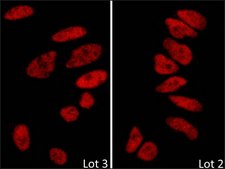 Rabbit anti-BRD2 Antibody, Affinity Purified Powered by Bethyl Laboratories, Inc.