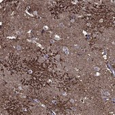 Anti-SLC1A2 antibody produced in rabbit Prestige Antibodies® Powered by Atlas Antibodies, affinity isolated antibody, buffered aqueous glycerol solution