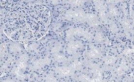 Anti-Aquaporin-1 Antibody, clone 2I7 ZooMAb® Rabbit Monoclonal recombinant, expressed in HEK 293 cells