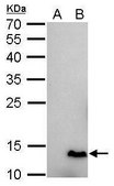 单克隆抗 6X His 标签 小鼠抗 clone GT161, affinity isolated antibody
