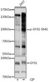Anti-Phospho-GYS1-S641 antibody produced in rabbit