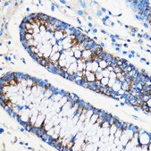 Anti-ATF6 antibody produced in rabbit